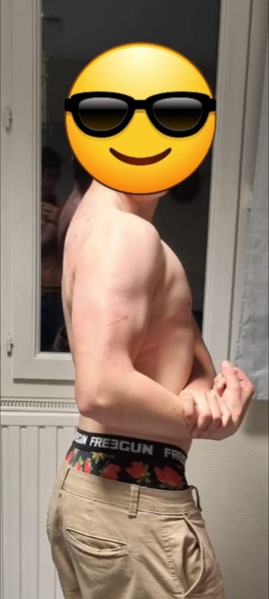 Profil de Dolan
